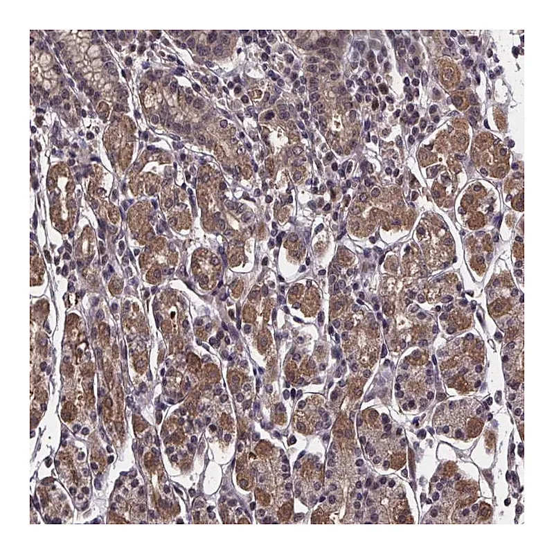 Atlas Antibodies Anti-FN3KRP Antibody