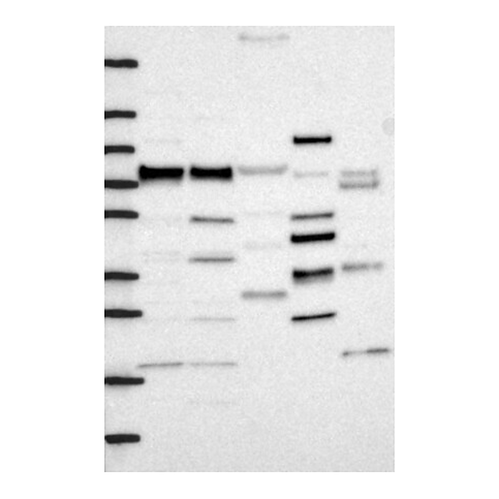 Atlas Antibodies Anti-FNBP1 Antibody