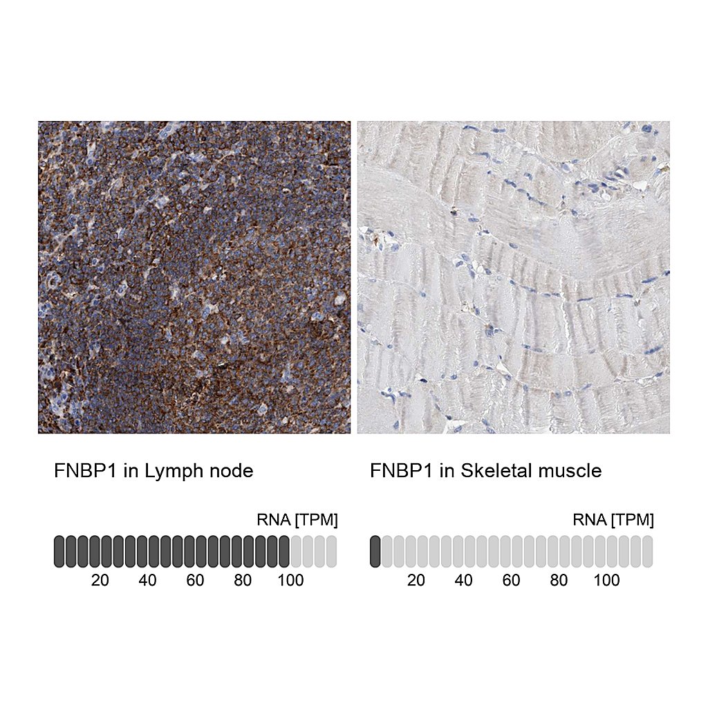 Atlas Antibodies Anti-FNBP1 Antibody