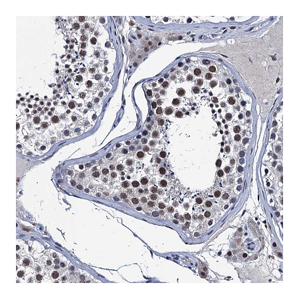 Atlas Antibodies Anti-FNBP4 Antibody