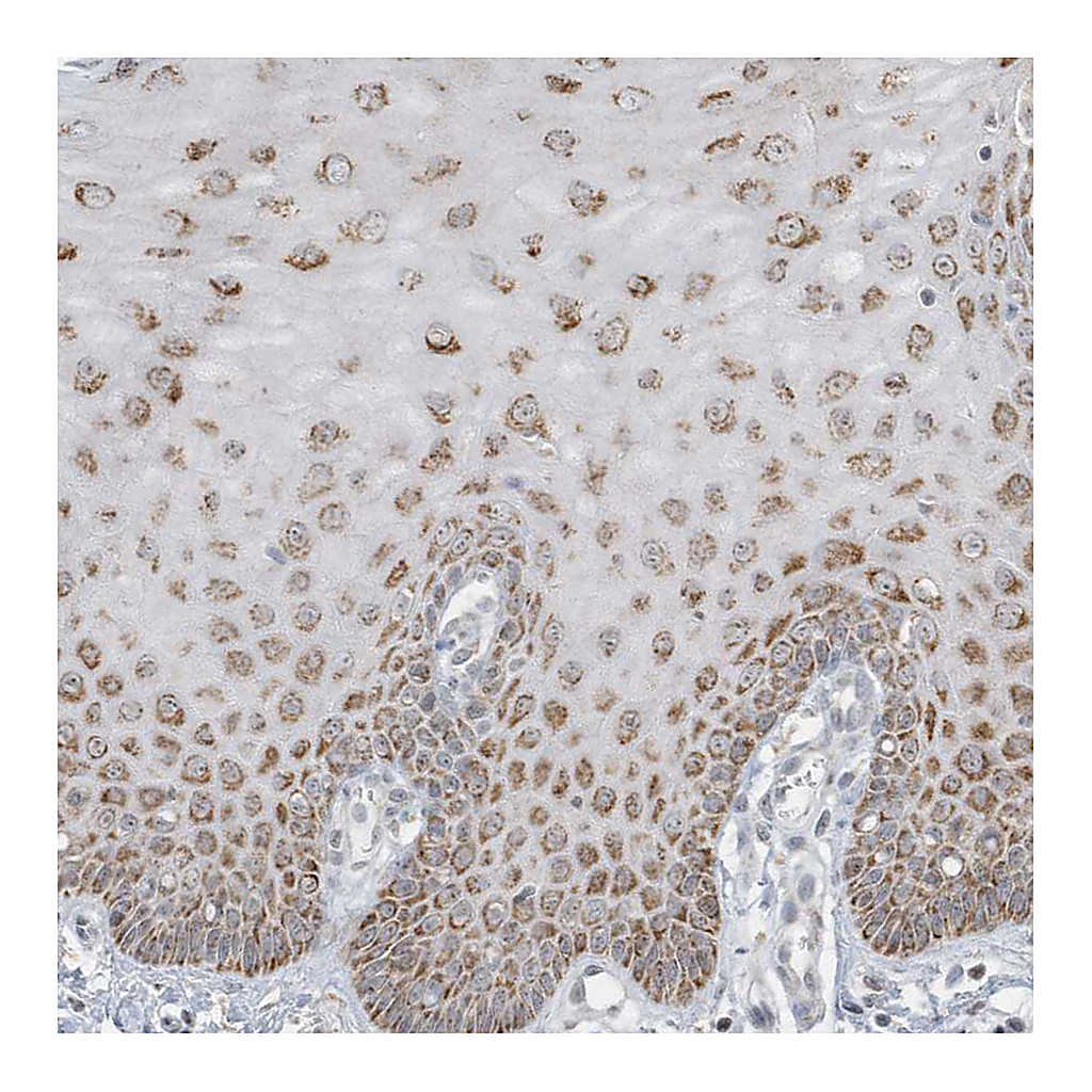 Atlas Antibodies Anti-FNDC1 Antibody