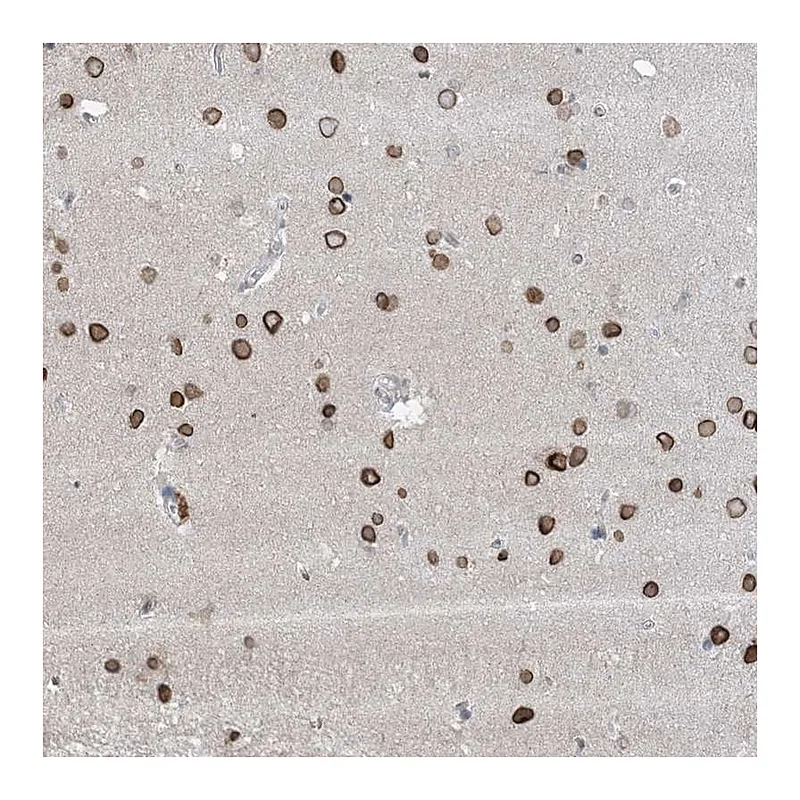 Atlas Antibodies Anti-FNDC1 Antibody