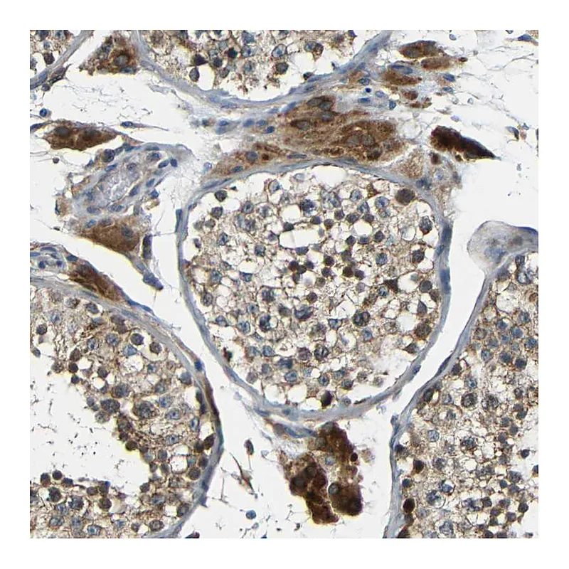 Atlas Antibodies Anti-FNDC3A Antibody