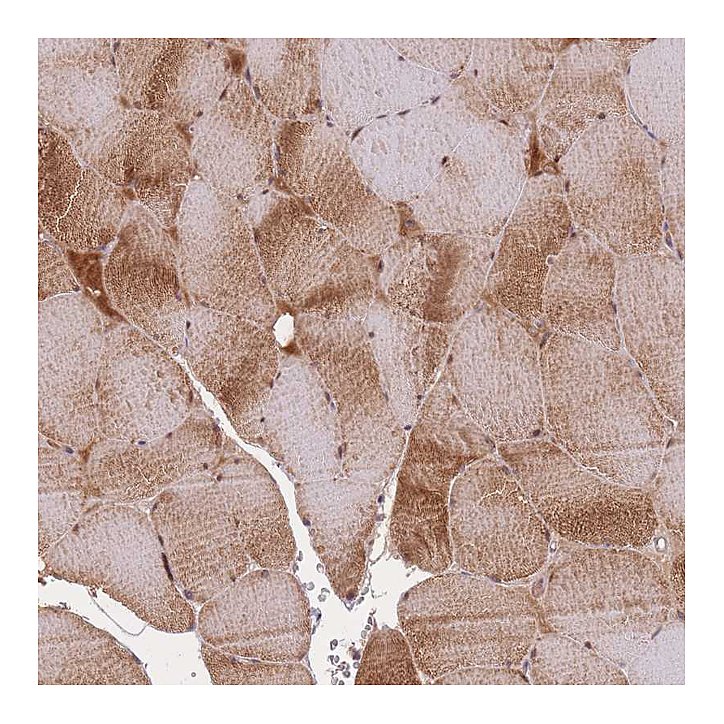 Atlas Antibodies Anti-FNDC5 Antibody