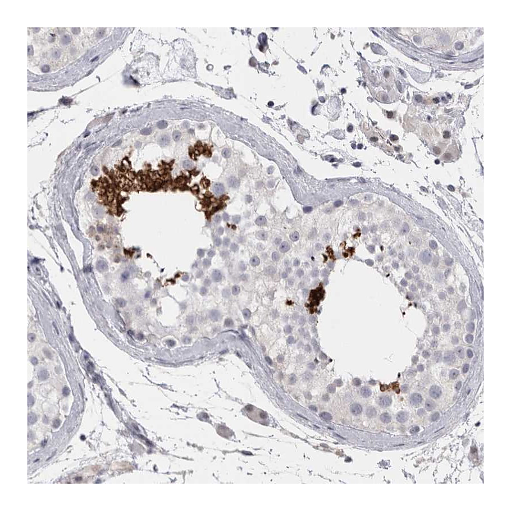 Atlas Antibodies Anti-FNDC8 Antibody