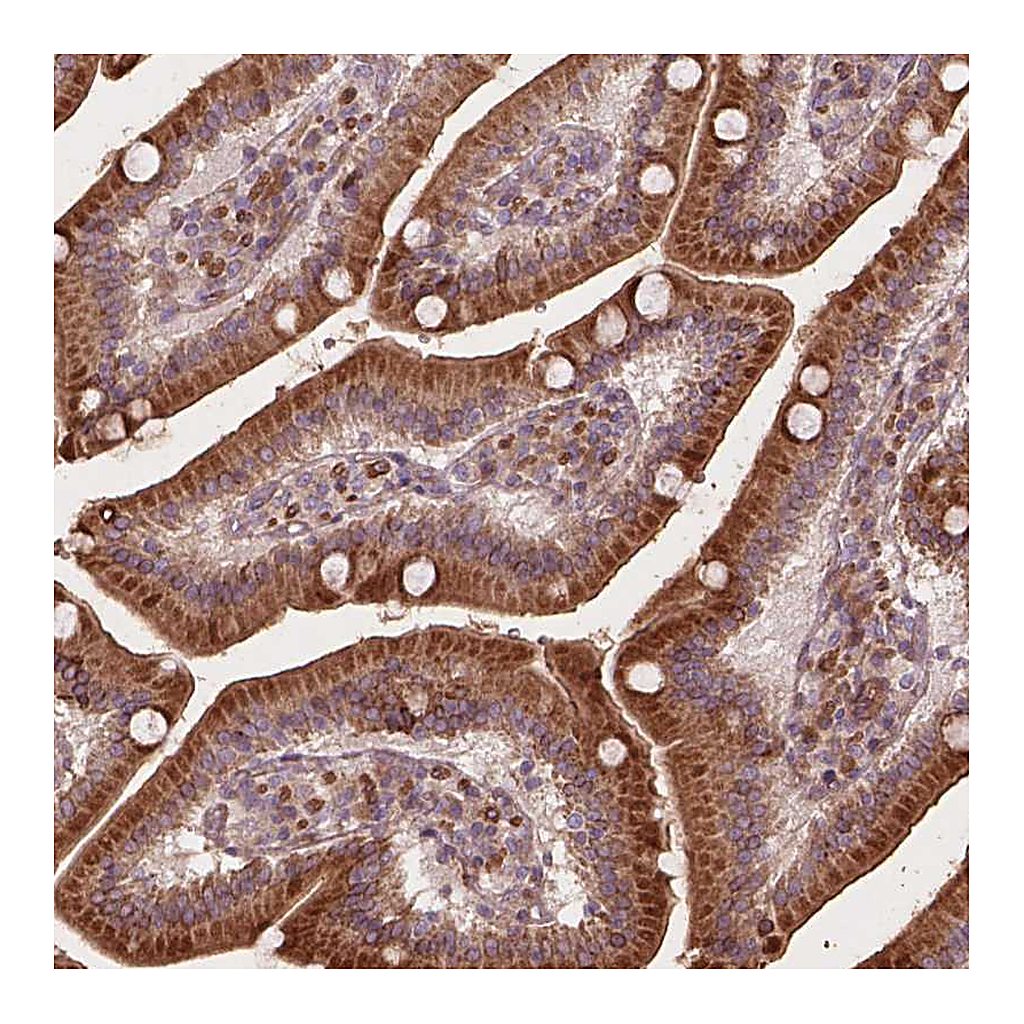 Atlas Antibodies Anti-FNIP1 Antibody