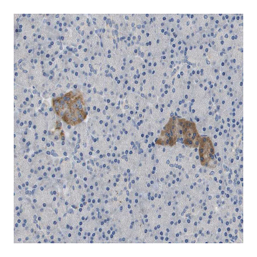 Atlas Antibodies Anti-FNDC9 Antibody