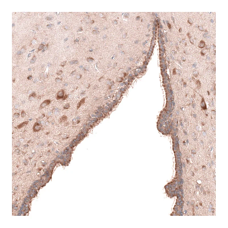 Atlas Antibodies Anti-FOCAD Antibody
