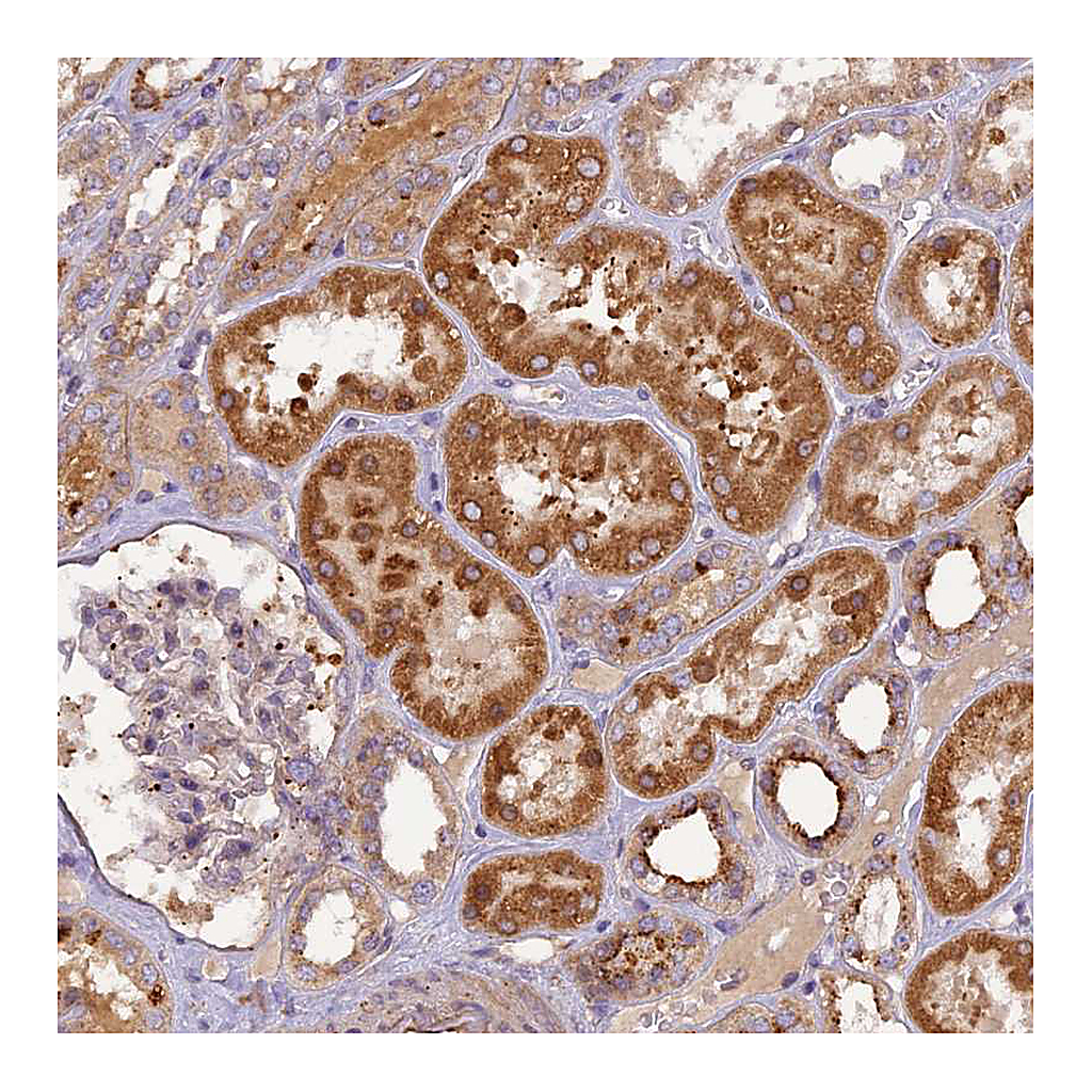Atlas Antibodies Anti-FNIP2 Antibody