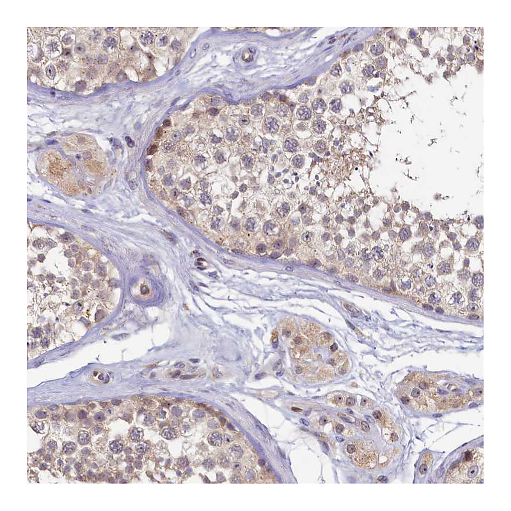 Atlas Antibodies Anti-FOPNL Antibody