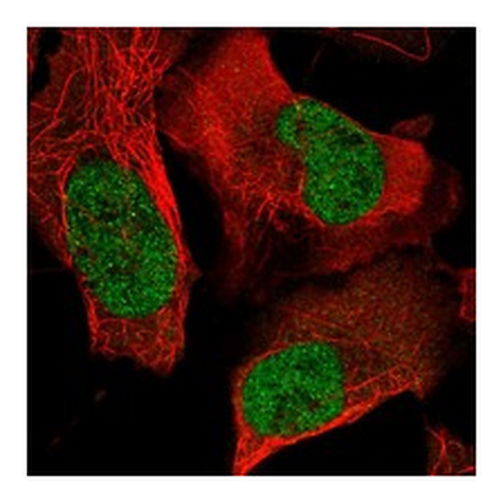 Atlas Antibodies Anti-FOSL1 Antibody