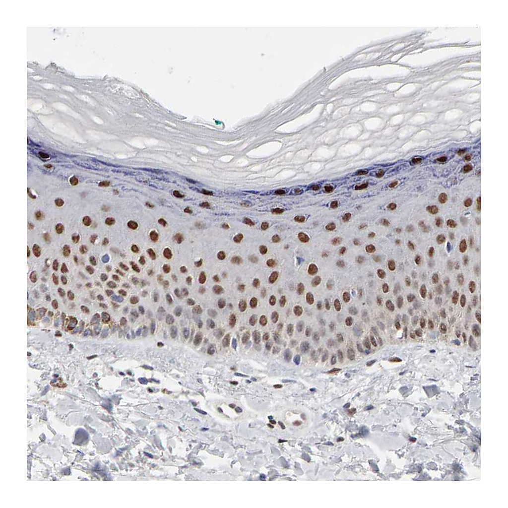 Atlas Antibodies Anti-FOSL2 Antibody