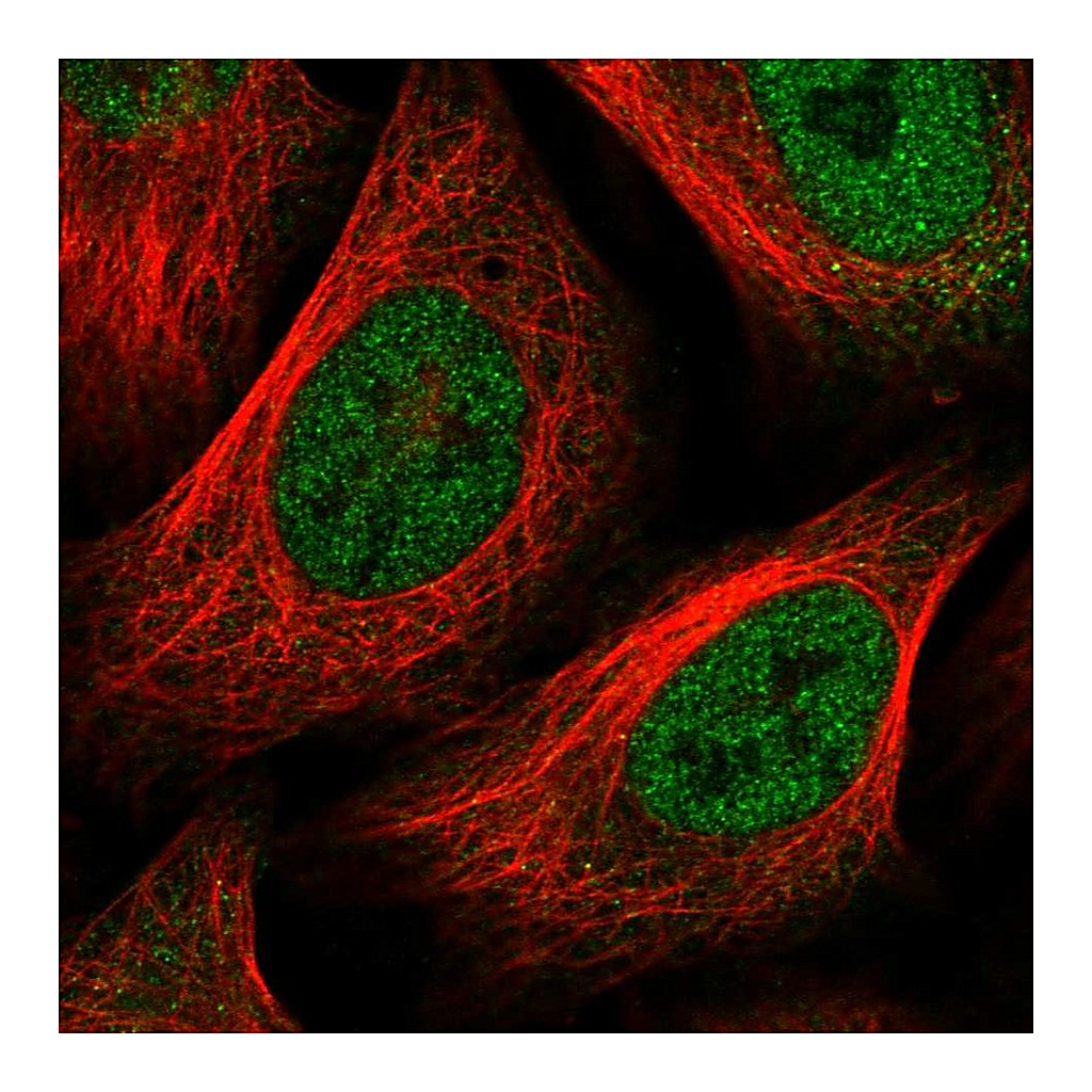 Atlas Antibodies Anti-FOXC1 Antibody