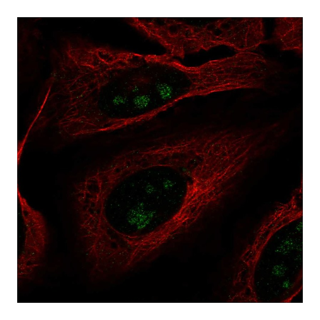 Atlas Antibodies Anti-FOXL2NB Antibody