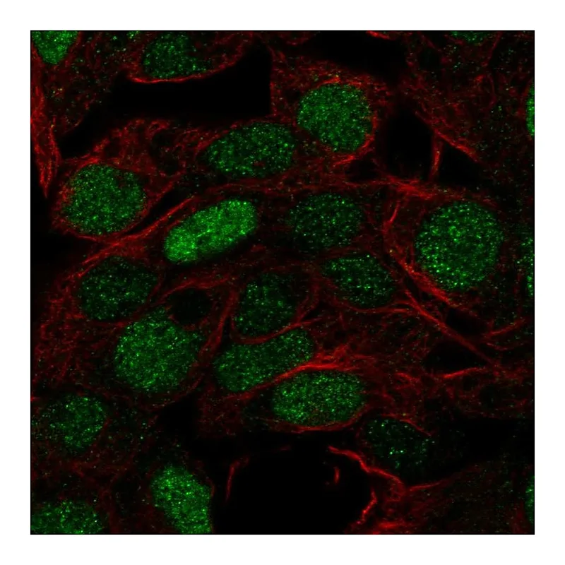 Atlas Antibodies Anti-FOXQ1 Antibody