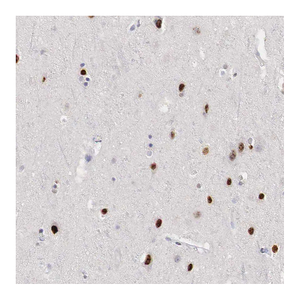 Atlas Antibodies Anti-FOXP2 Antibody