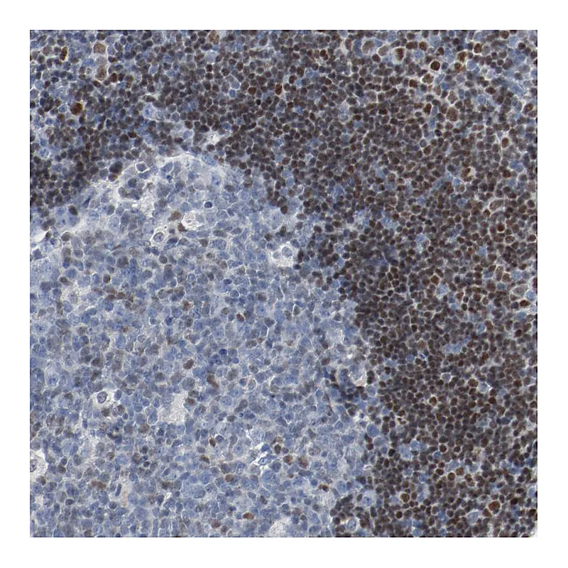 Atlas Antibodies Anti-FOXP1 Antibody
