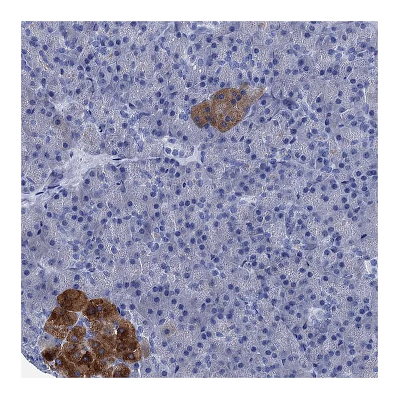 Atlas Antibodies Anti-FOXR2 Antibody