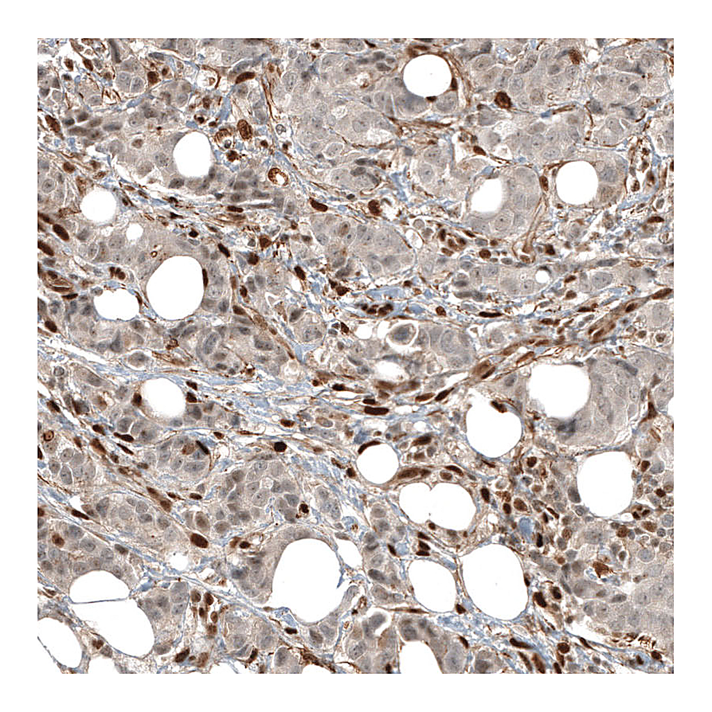 Atlas Antibodies Anti-FOXR2 Antibody