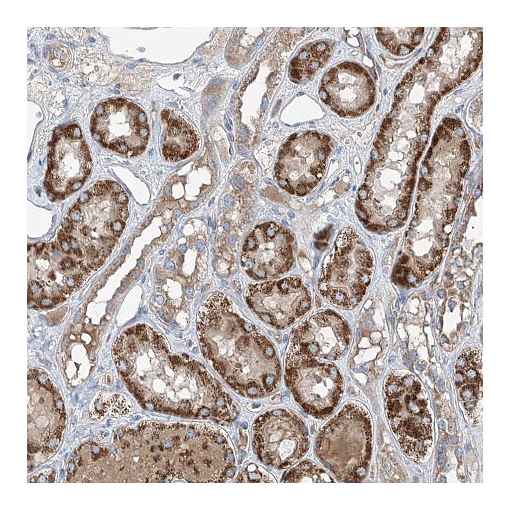 Atlas Antibodies Anti-FOXRED2 Antibody