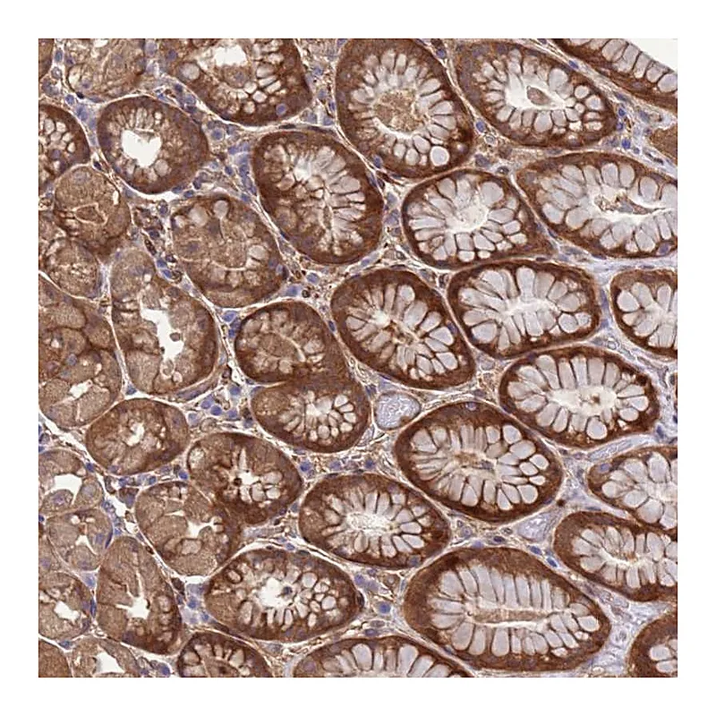 Atlas Antibodies Anti-FOXRED1 Antibody