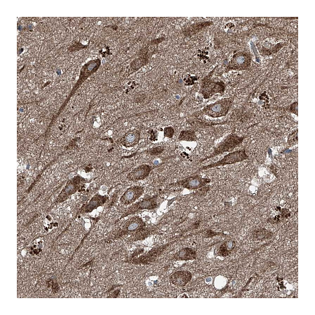 Atlas Antibodies Anti-FOXRED2 Antibody