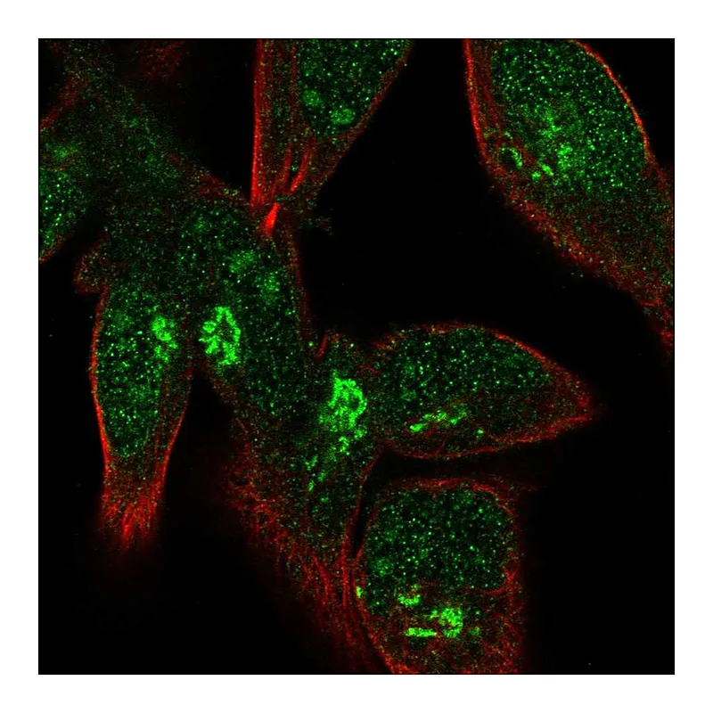 Atlas Antibodies Anti-FPR1 Antibody