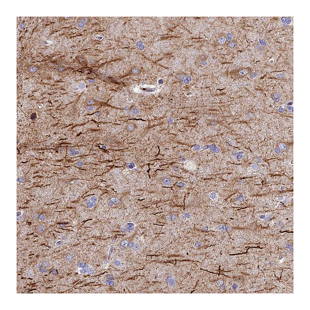 Atlas Antibodies Anti-FRA10AC1 Antibody