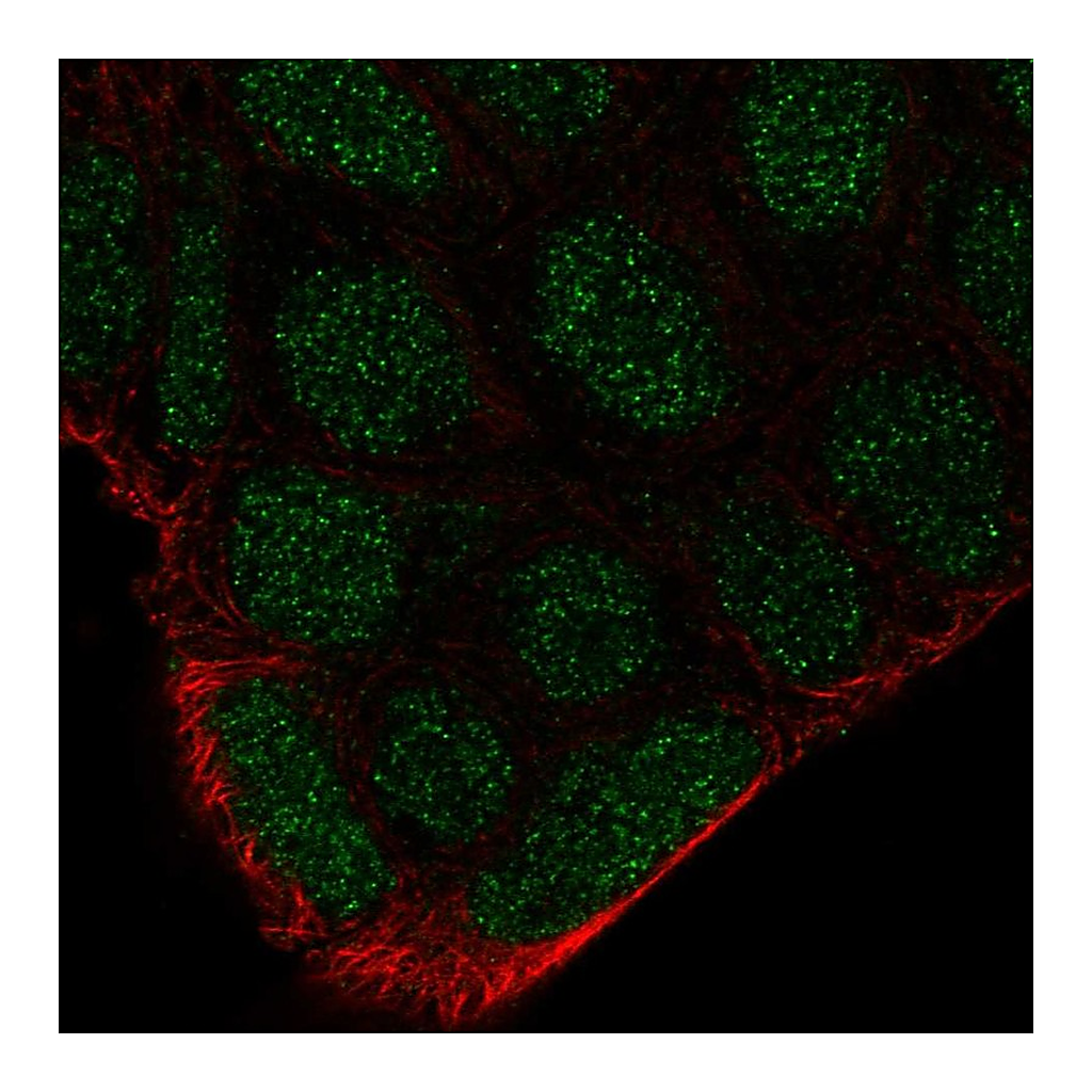 Atlas Antibodies Anti-FRK Antibody