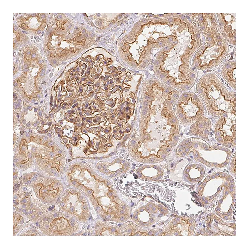 Atlas Antibodies Anti-FRAS1 Antibody