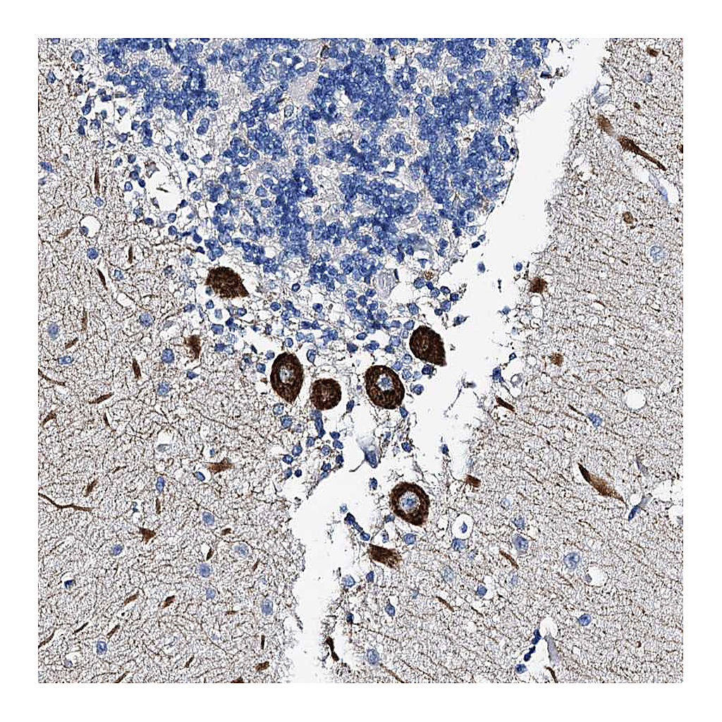 Atlas Antibodies Anti-FREM3 Antibody