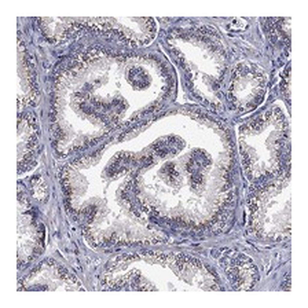 Atlas Antibodies Anti-FRG1 Antibody