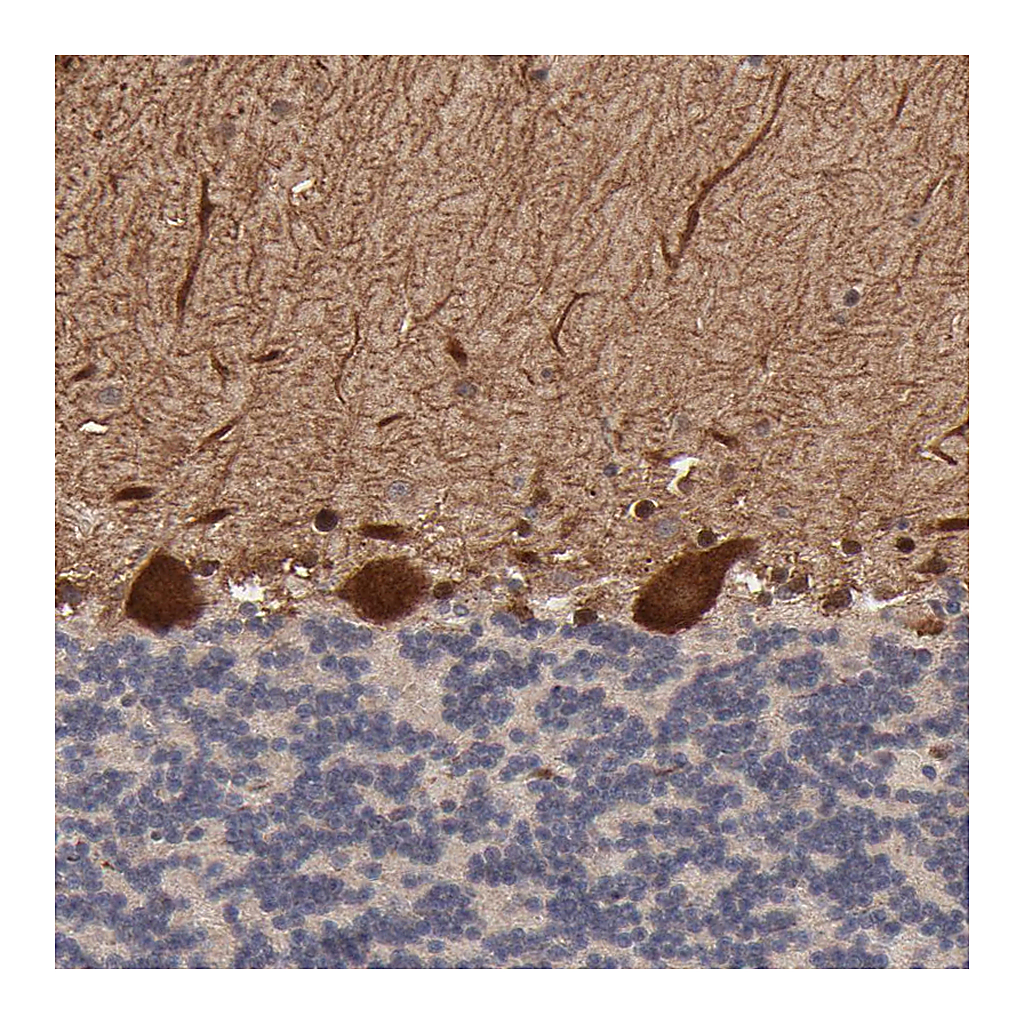 Atlas Antibodies Anti-FRMD8 Antibody
