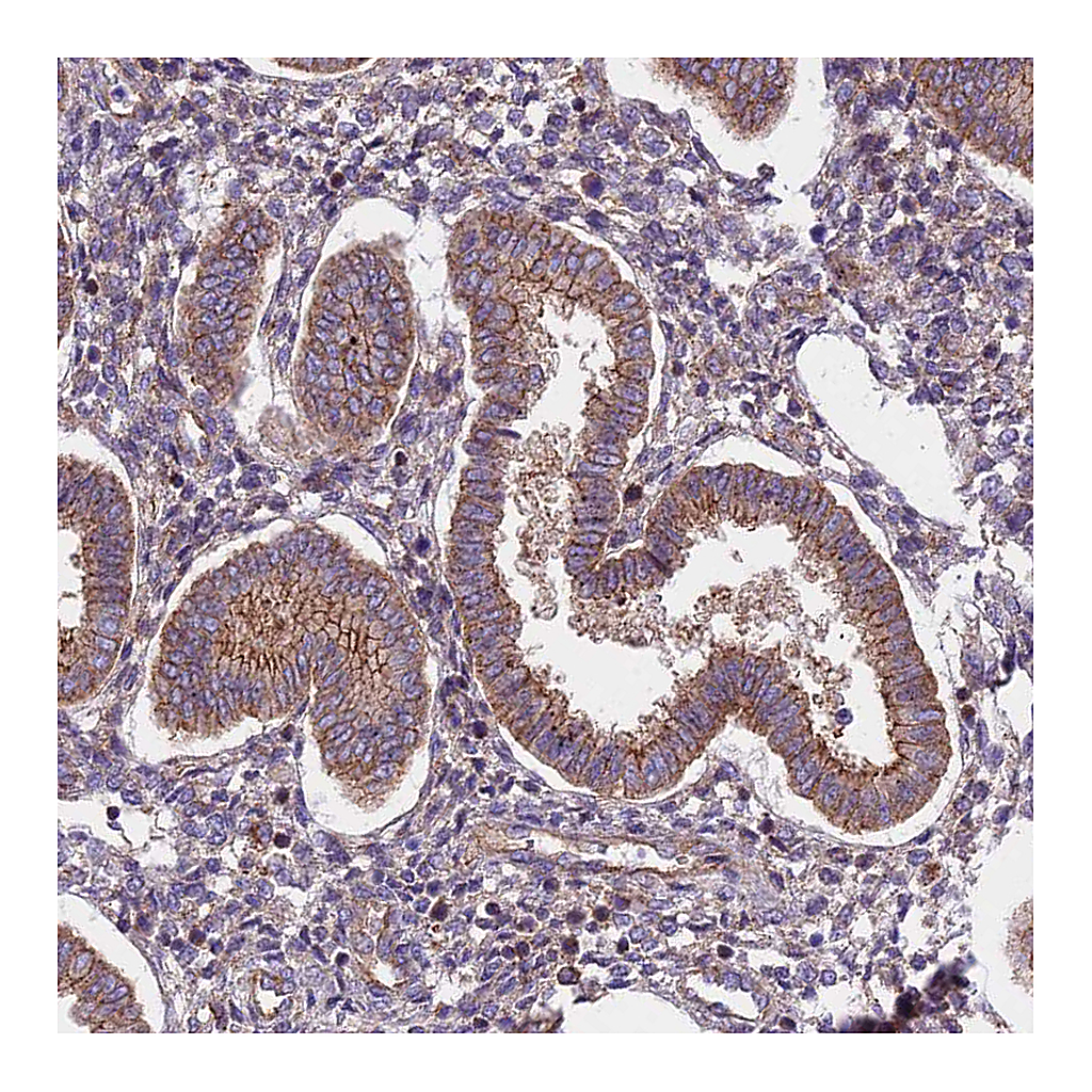 Atlas Antibodies Anti-FRMPD1 Antibody