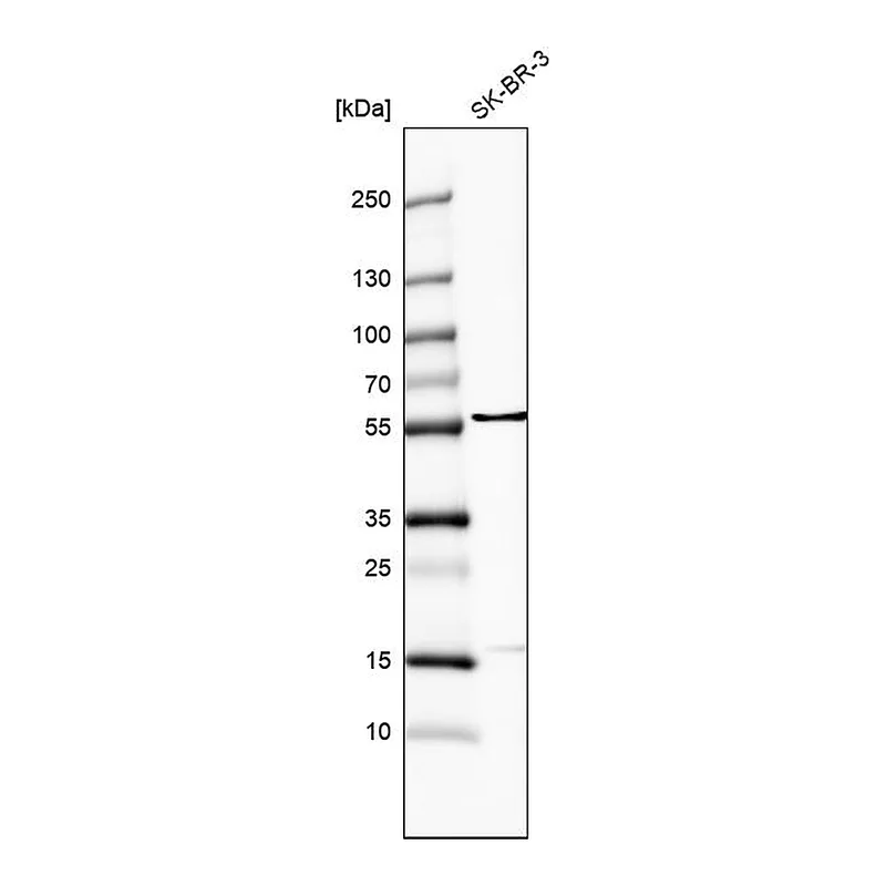 Atlas Antibodies Anti-FRMD8 Antibody