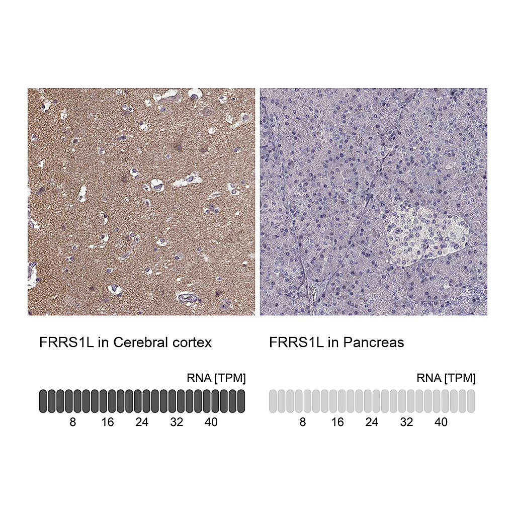 Atlas Antibodies Anti-FRRS1L Antibody