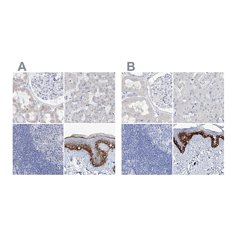 Atlas Antibodies Anti-FRS3 Antibody