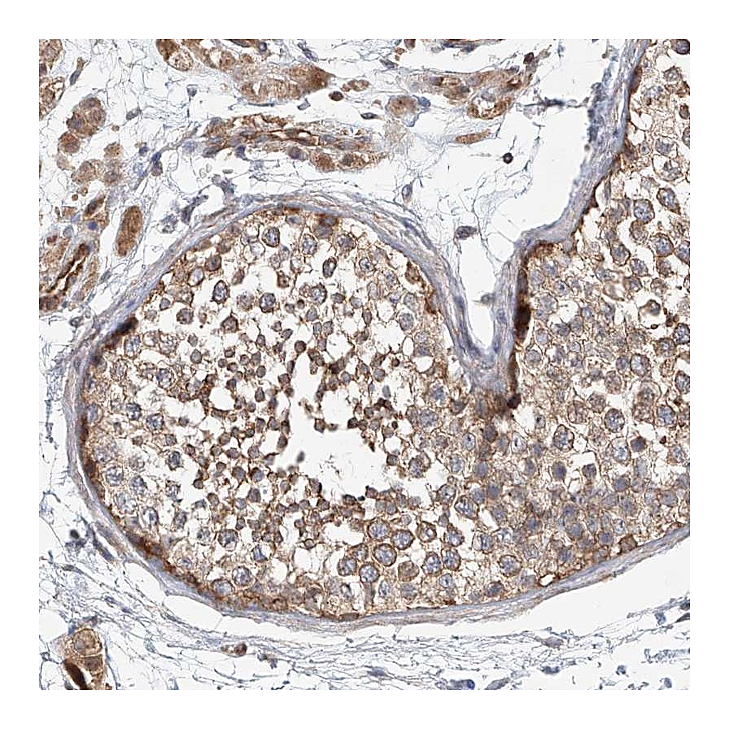 Atlas Antibodies Anti-FRYL Antibody