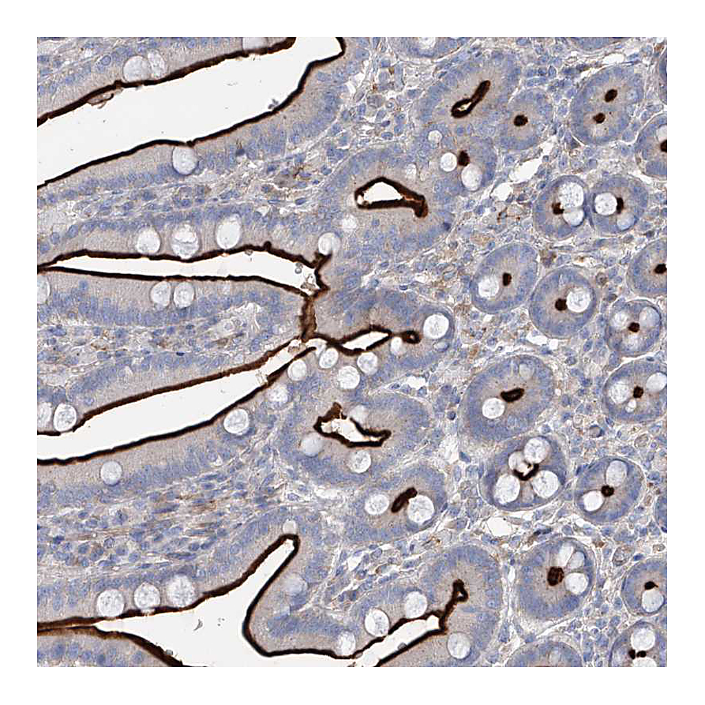 Atlas Antibodies Anti-FRYL Antibody