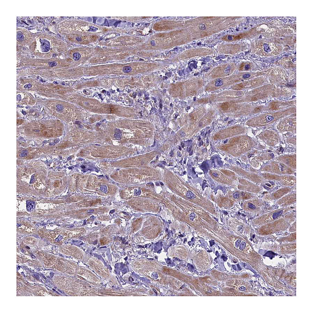 Atlas Antibodies Anti-FRY Antibody