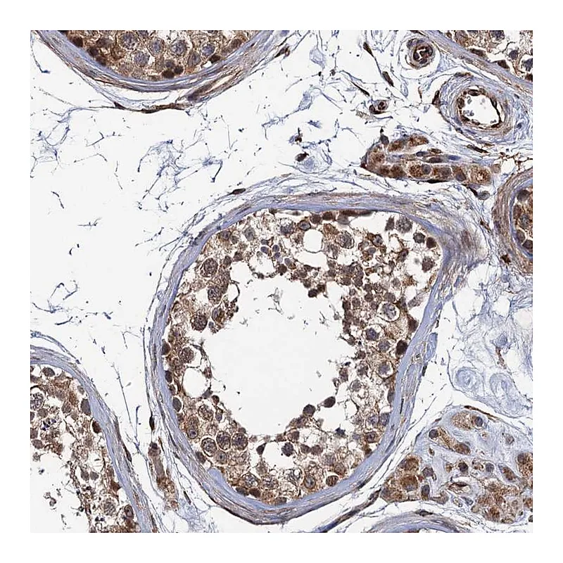 Atlas Antibodies Anti-FSIP1 Antibody
