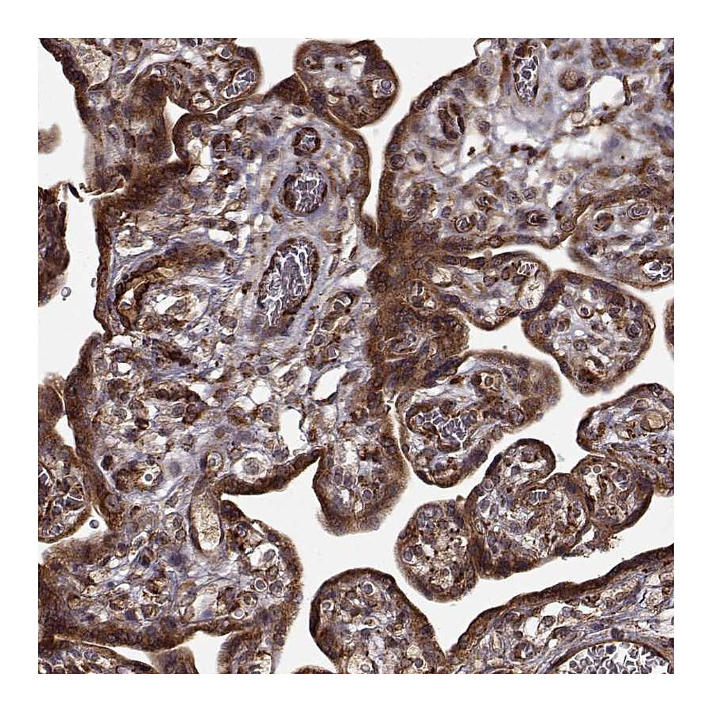 Atlas Antibodies Anti-FSTL1 Antibody