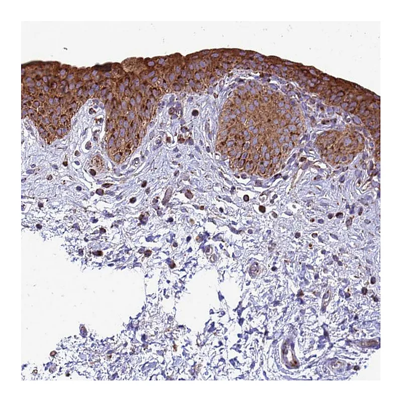 Atlas Antibodies Anti-FSTL4 Antibody