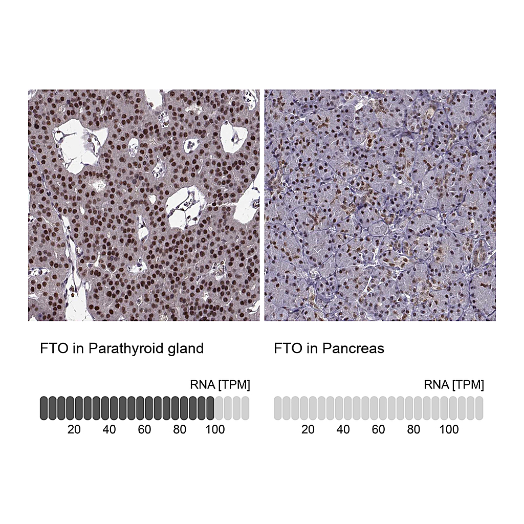 Atlas Antibodies Anti-FTO Antibody