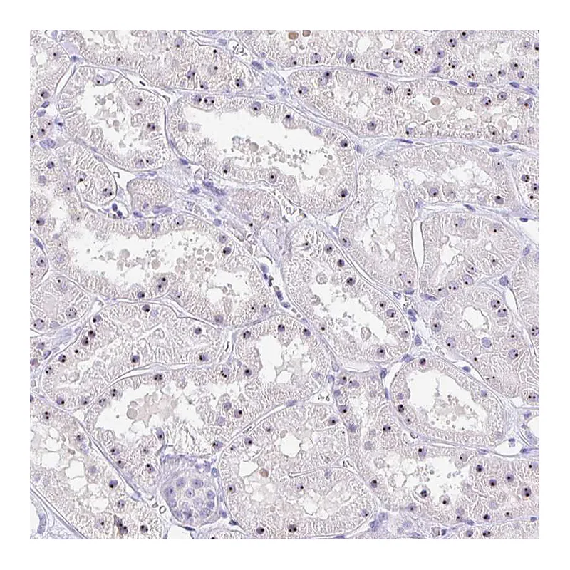 Atlas Antibodies Anti-FTSJ3 Antibody