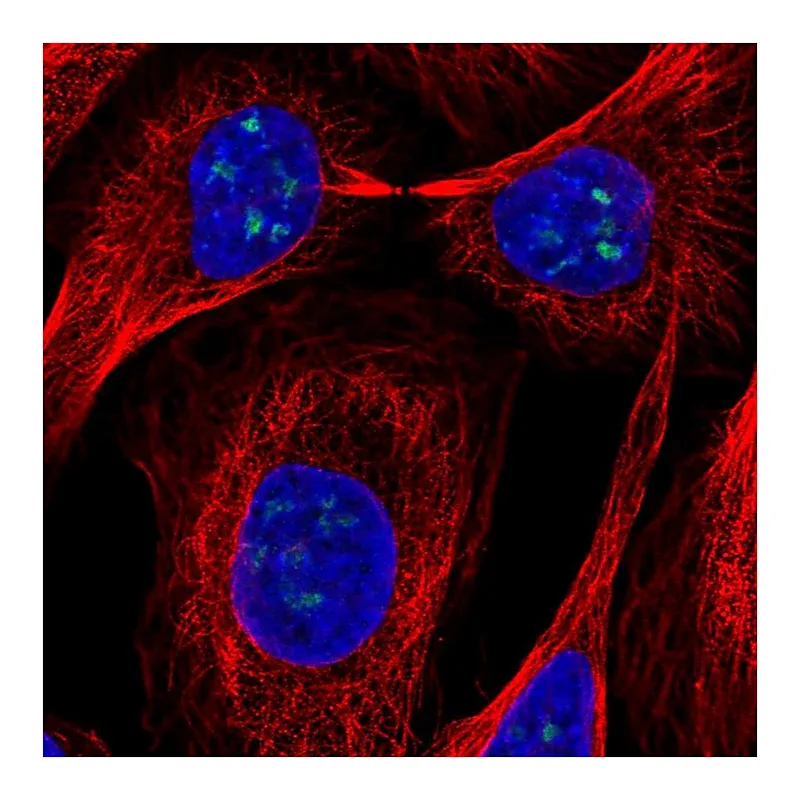 Atlas Antibodies Anti-FTSJ3 Antibody