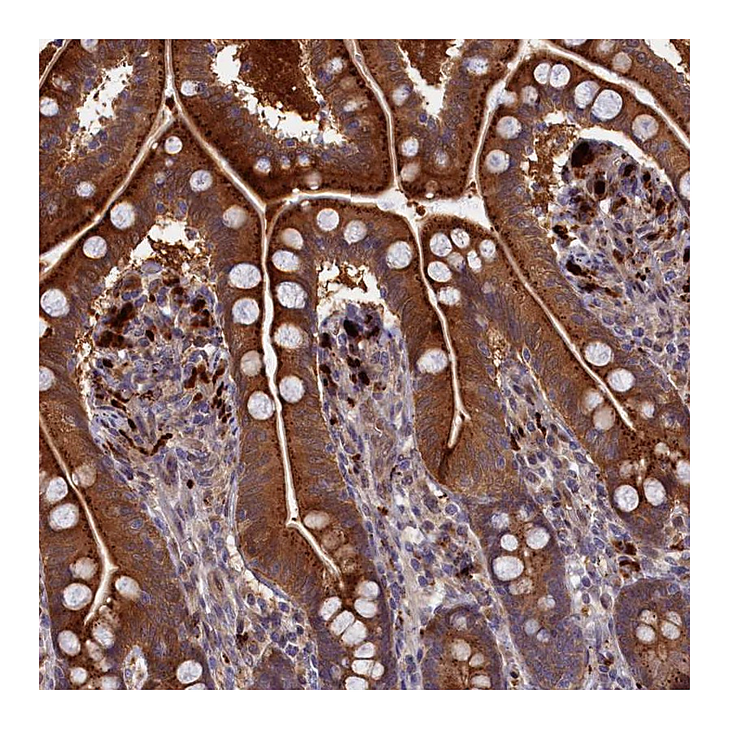 Atlas Antibodies Anti-FUK Antibody