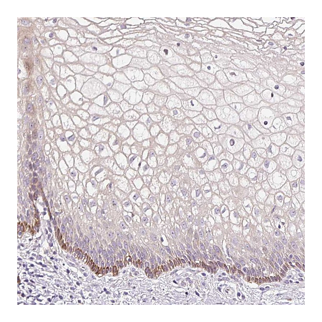 Atlas Antibodies Anti-FUT10 Antibody