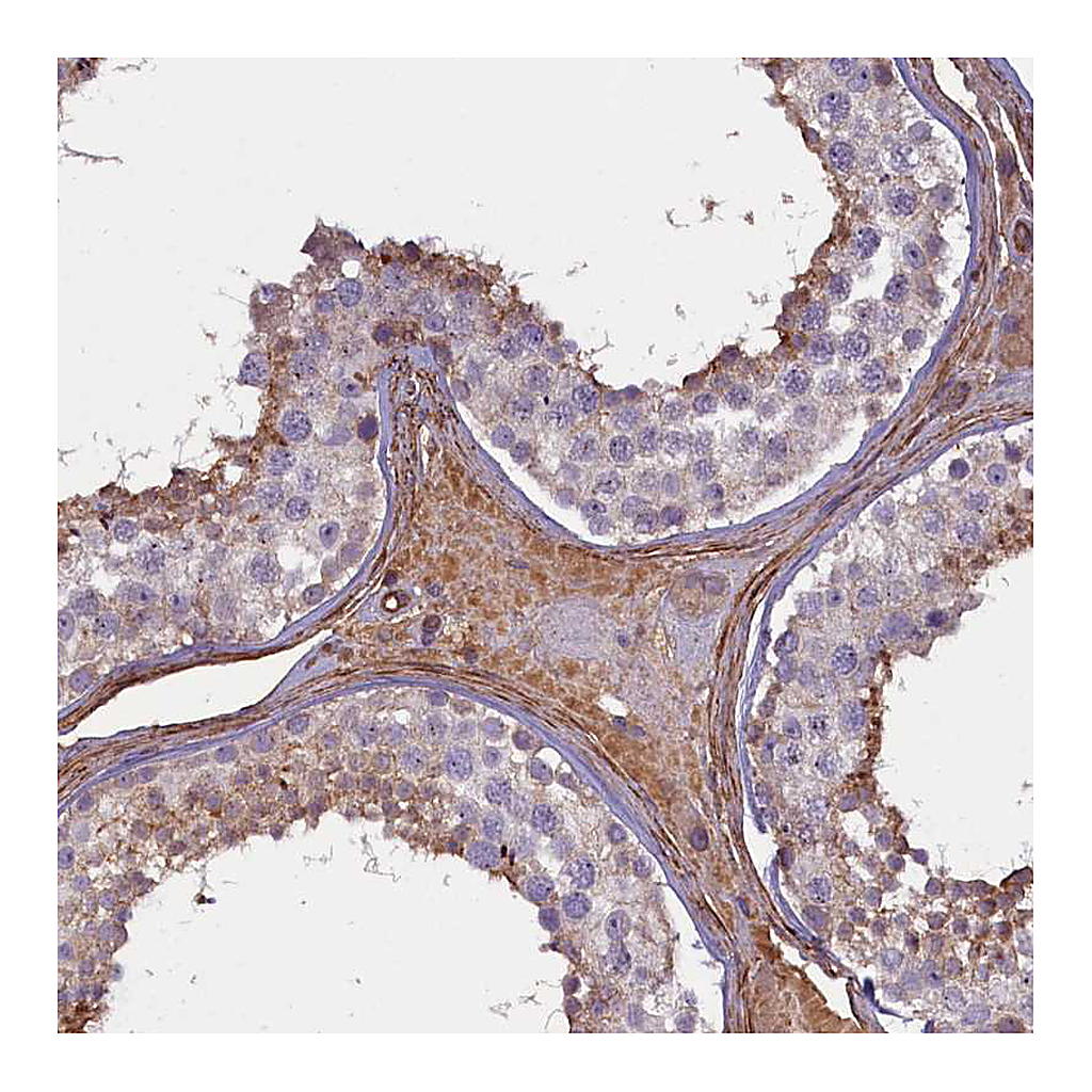 Atlas Antibodies Anti-FUZ Antibody