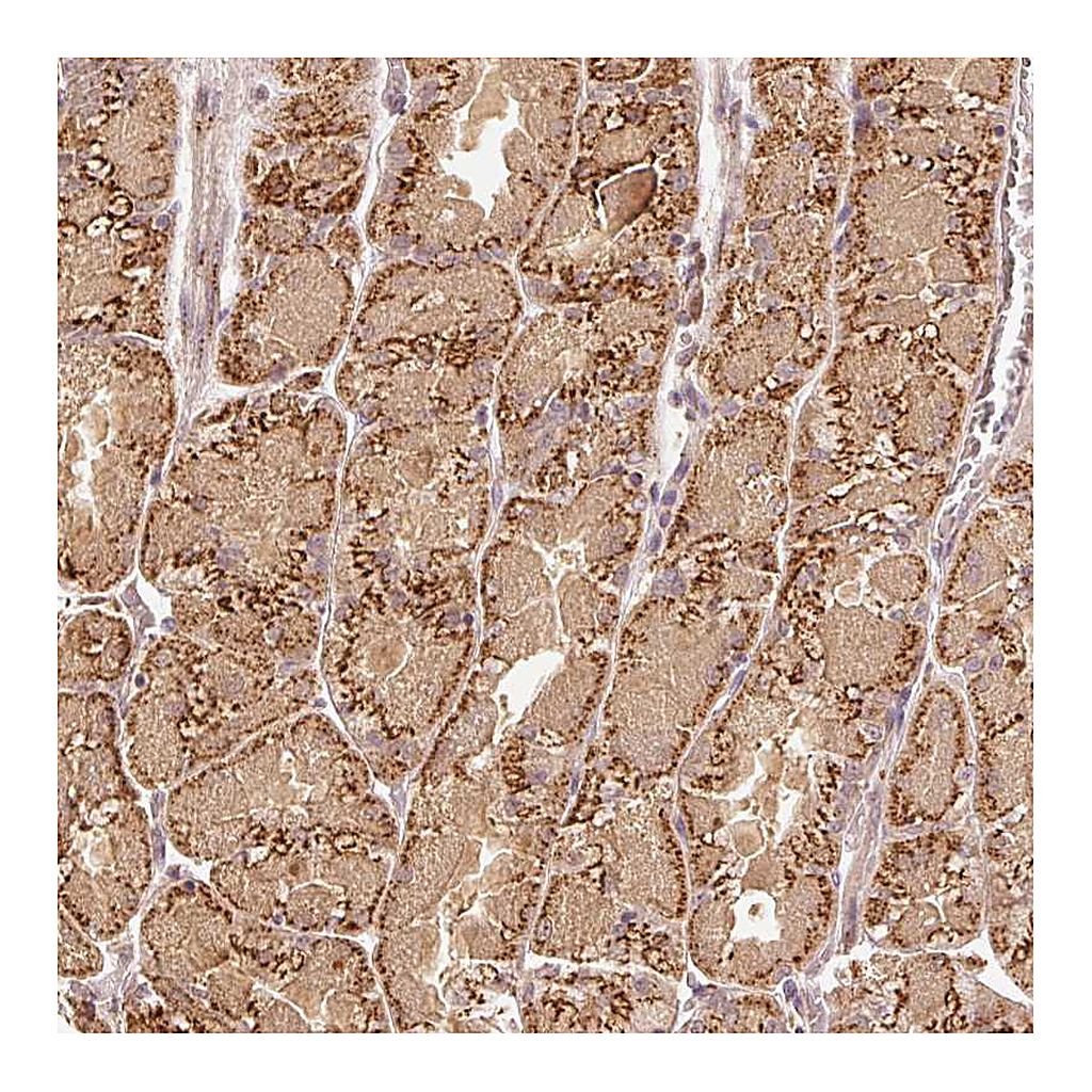 Atlas Antibodies Anti-FUT8 Antibody